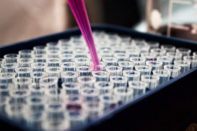 Food Lab Testing